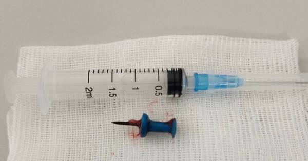 В Улан-Удэ подросток вдохнул в бронхи канцелярский гвоздик 