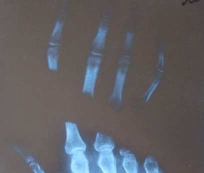 � ������� ��� ������� ���� ������ � ���� 