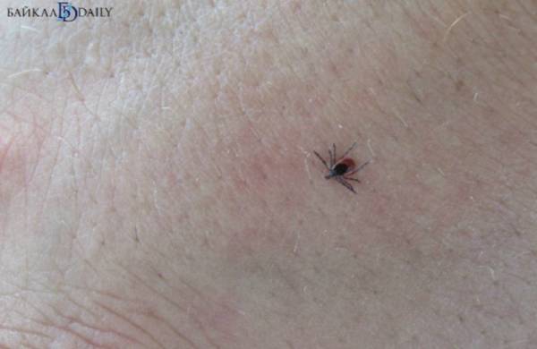 В Бурятии клещи за неделю укусили 54 человека