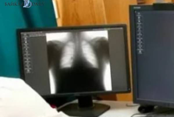 В Улан-Удэ поступил импортный аппарат для диагностике туберкулёза