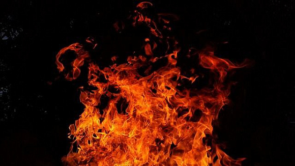 В Забайкалье скончался мальчик, получивший обширные ожоги на пожаре 