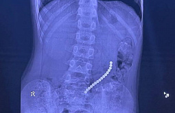 � �������� ����� ������ ������, ������������� 16 ��������� ��������