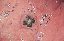 � ������ ������� ���������� ��������� ����� ����