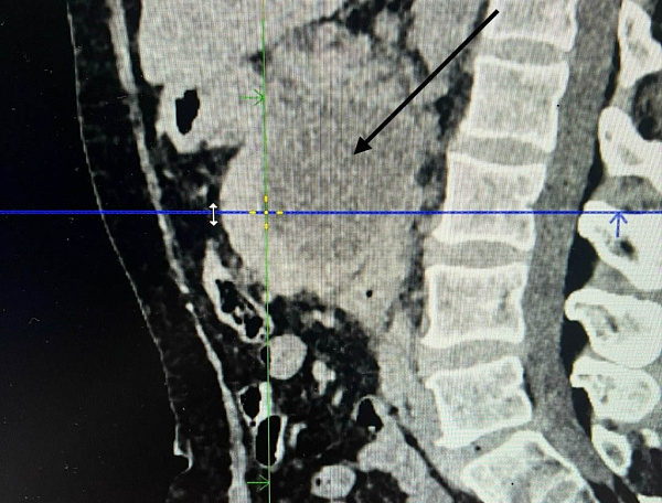 ����� ������� ��������� ���������� �������� �� �������������