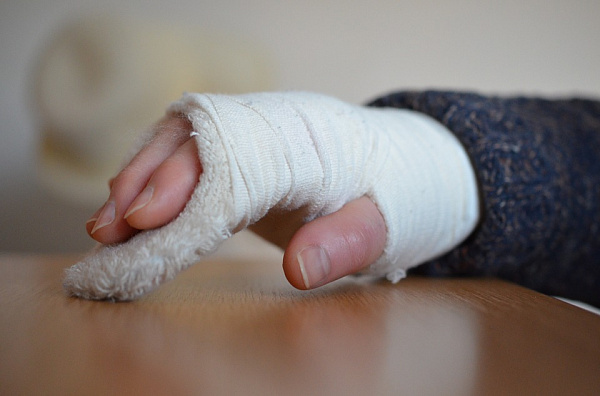 В Улан-Удэ школьница сломала руку на уроке физкультуры
