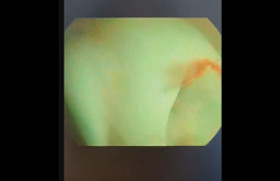 � ���������� ������� � ����� ����� ���