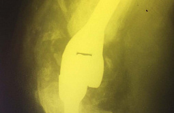 � ����-��� ������� ������� ������������������ ��������� �������