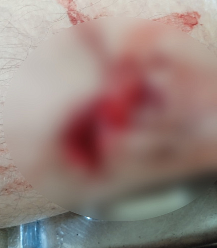В Улан-Удэ собака напала на мужчину возле детского сада 