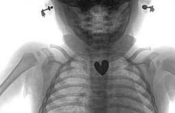 � ������� ������������� ������� ���������� ������