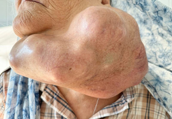 � ������ ������� �� ����������� �������� ���������� ������� �������