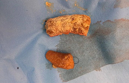 ����������� �� ������� ���� �� ������ ��-�� ����� � �����