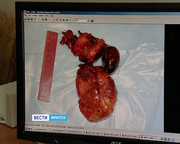 ��������� ����� ������� ������� ����������� � 30 ��� ���������