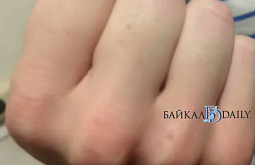 В Бурятии двое мужчин избили 15-летнего подростка