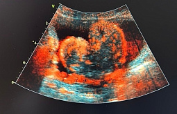 � ������ ������� ��������� ������� � ���� ������ 