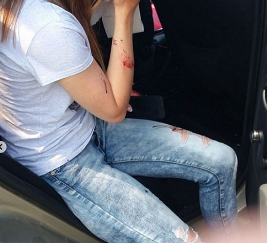В Улан-Удэ девушке из автошколы разбили лицо камнем 