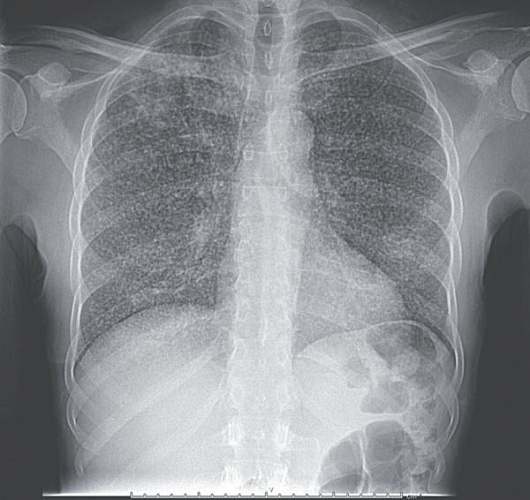 � ������� ���������� � �������� ���� � �����